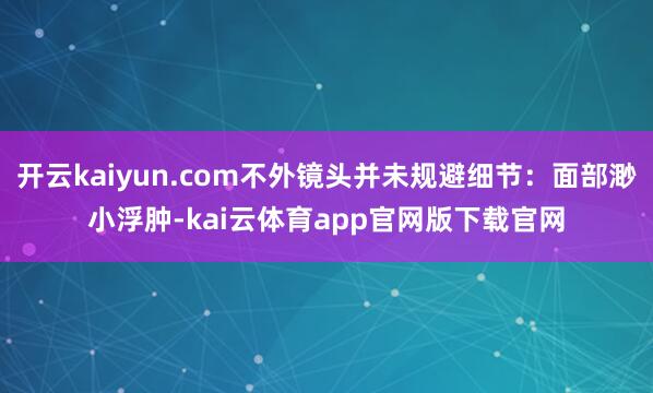 开云kaiyun.com不外镜头并未规避细节：面部渺小浮肿-kai云体育app官网版下载官网